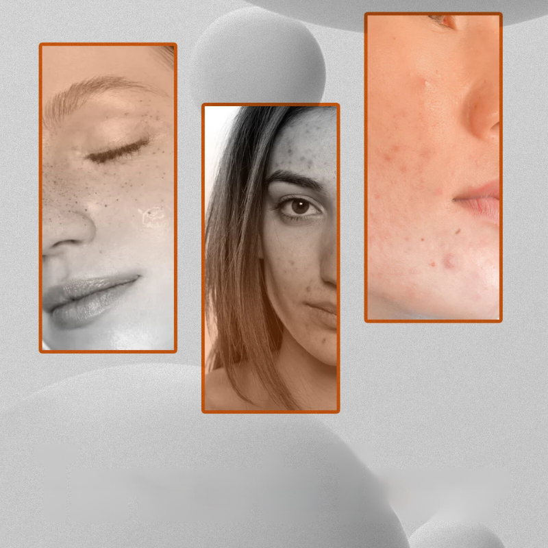 Tonik Spotless Glow – Korekcja Ciemnych Plam i Rozjaśnianie Skóry Twarzy