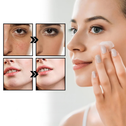 CalmAura Repair Cream – For Rosacea and Soothing Skin Redness