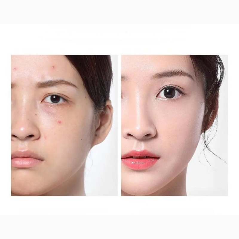 ClearSkin Ampoule Toner – Acne Care and Hydrating Serum