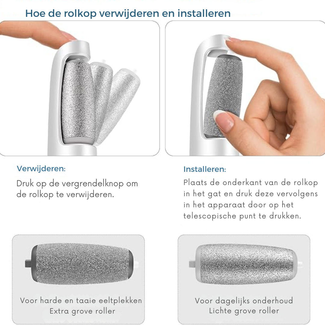 Elektromosowy usuwacz zrogowaceń – idealny do uzyskania gładkich i miękkich stóp