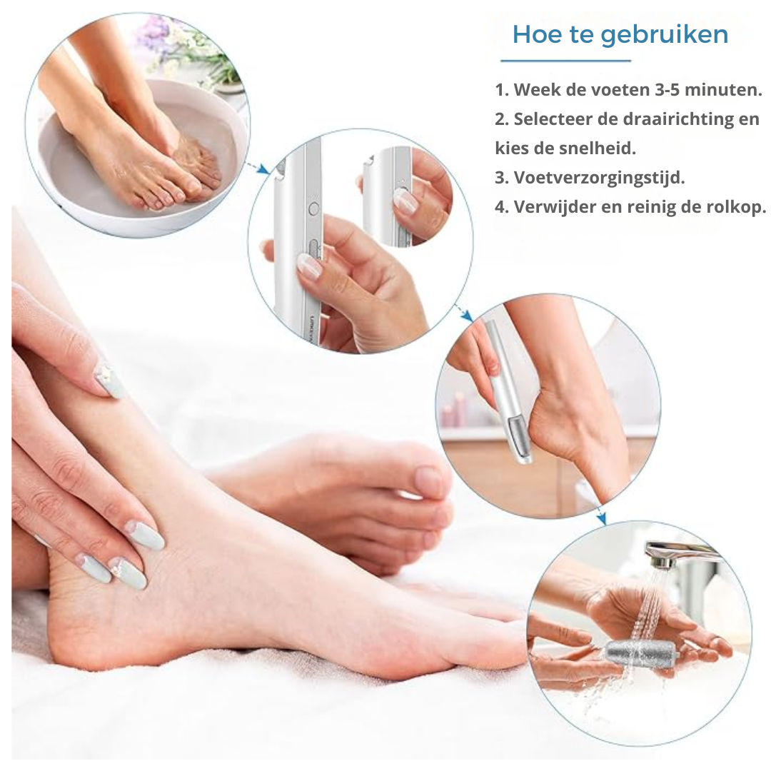 Elektromosowy usuwacz zrogowaceń – idealny do uzyskania gładkich i miękkich stóp