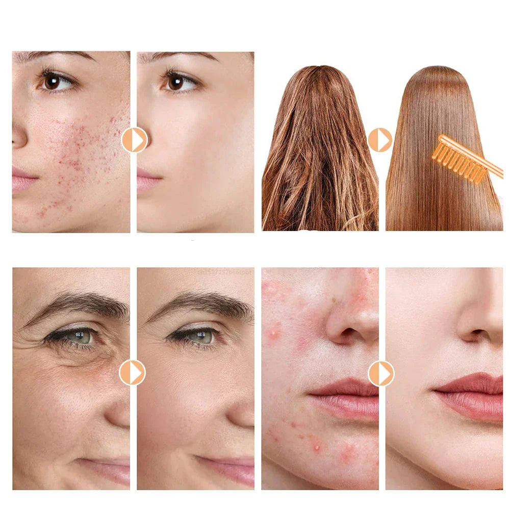 GlowWave - Wysokoczęstotliwościowa Lampa Elektrodowa do Ujędrniania Skóry i Redukcji Zmarszczek