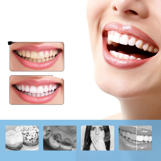 FreshWhite - 6-Mode Electric Toothbrush with Built-in Scaler